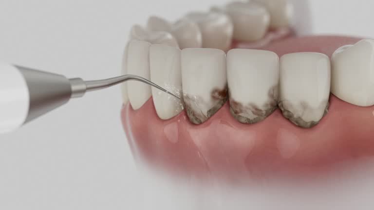 Reliable Root Canal Treatment contractor in Owen County County, KY by Dentist Open Now